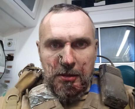 Олег Сенцов отримав поранення!