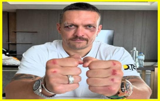 Усик показав, як виглядає після перемоги над Ф'юрі