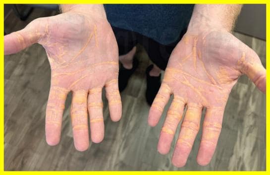 Американець щодня з'їдав до 4 кілограмів сиру