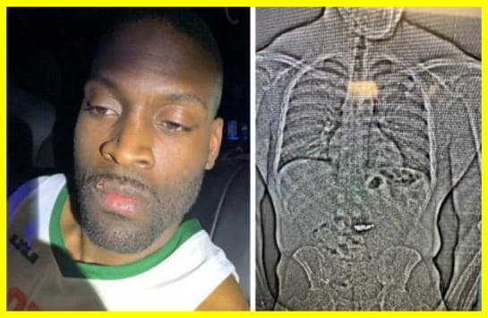 Злодій проковтнув діамантові сережки Tiffany