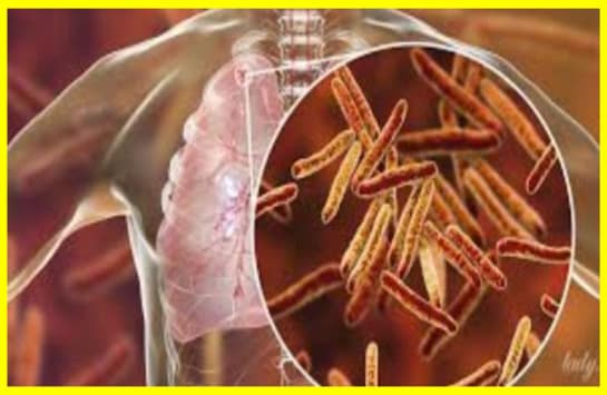 A new drug for tuberculosis